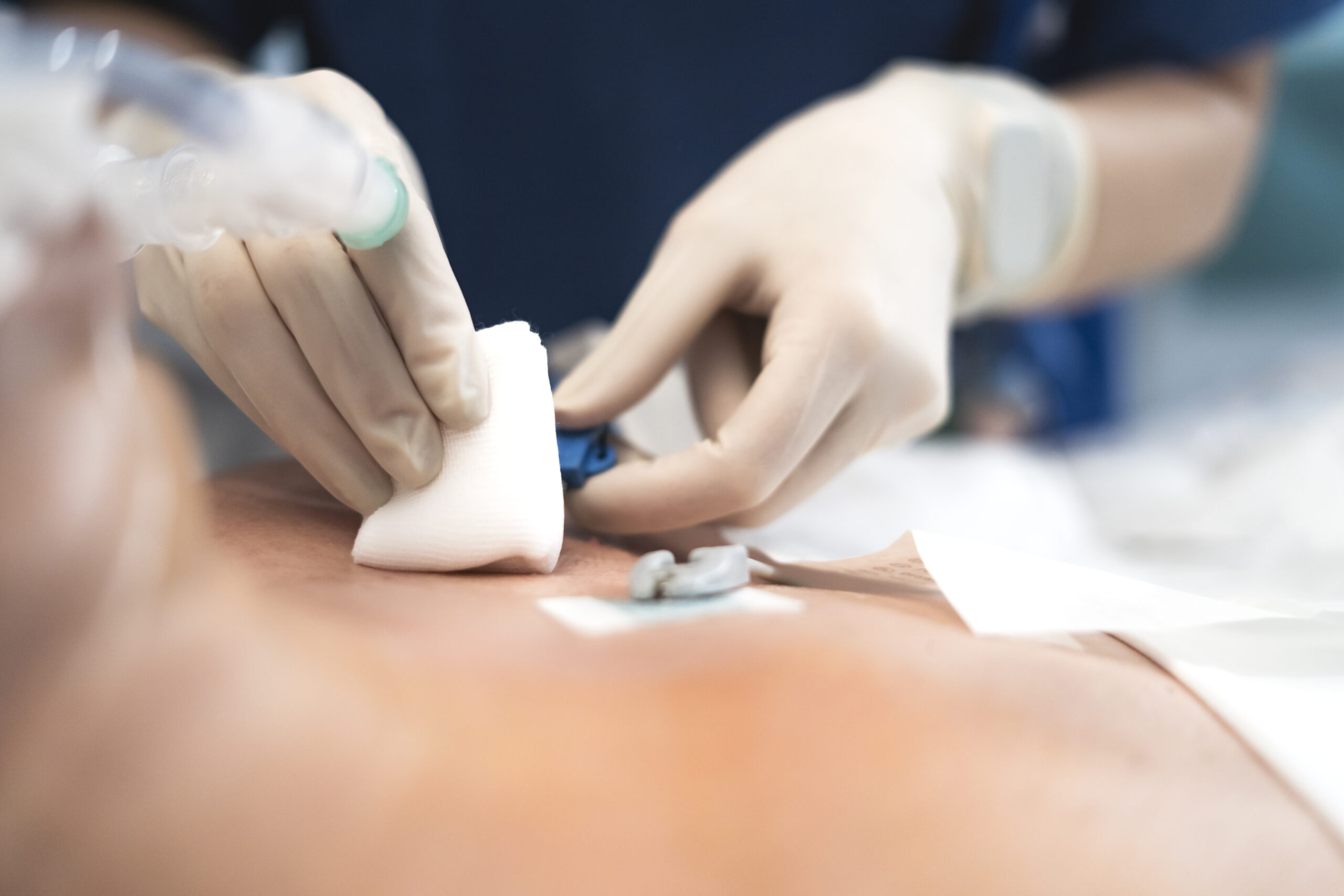 Nurse attaching catheter to patient's chest during medical procedure