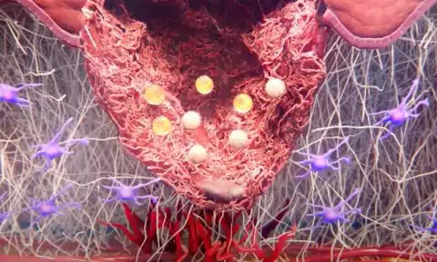 Oxigenoterapia Tópica Multimodal