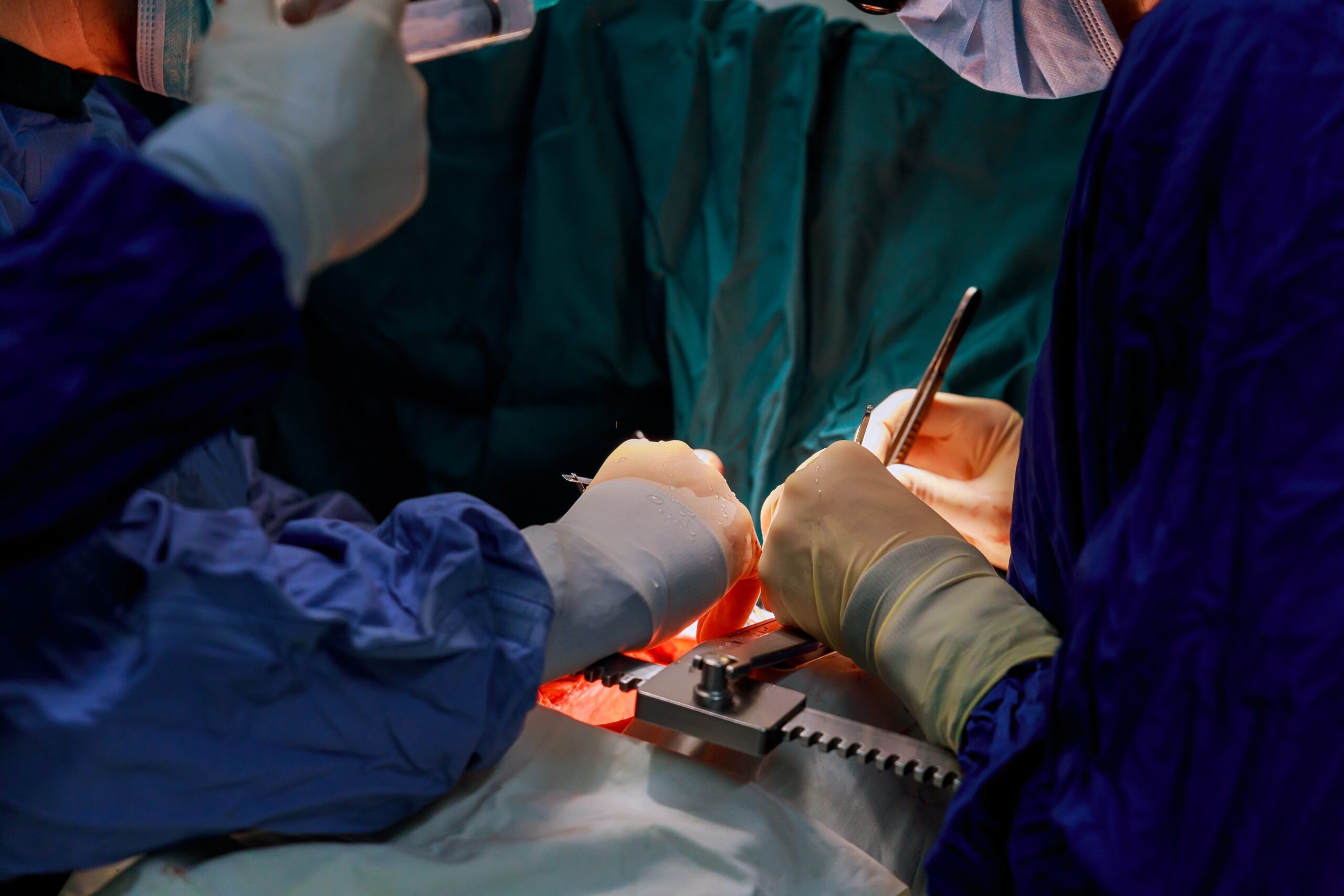 Donor Heart Procurement for Cardiac Transplantation Doctor doing heart operation
